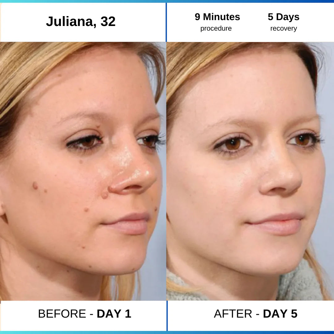 OcuraLife before and after result 1