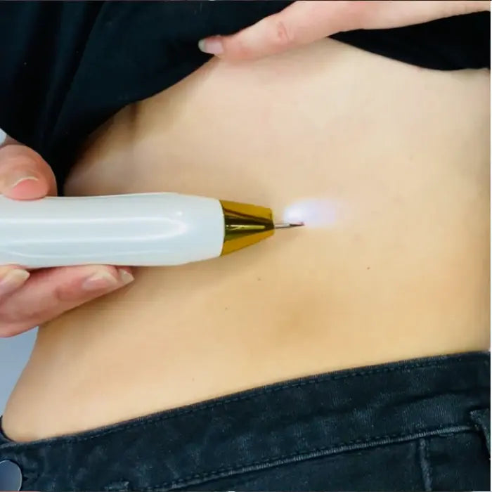 Perform the Treatment