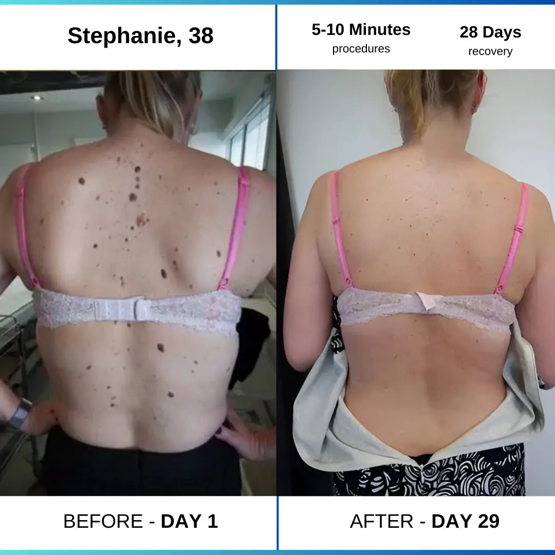 OcuraLife before and after result 3