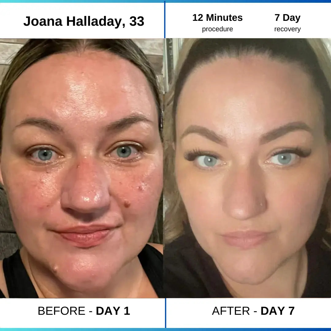 OcuraLife before and after result 2